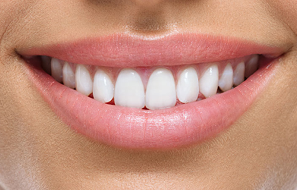 img-paniz-servizi-11-2