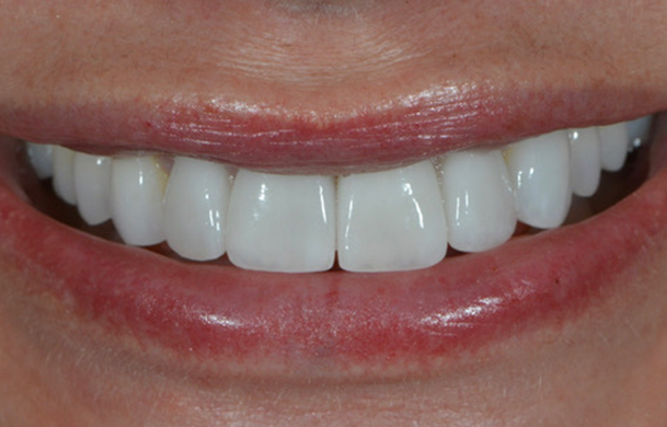 img-paniz-servizi-12-2