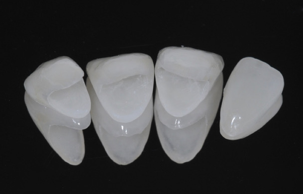 img-paniz-servizi-13-2