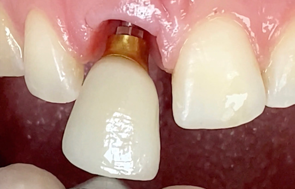 img-paniz-servizi-14-2