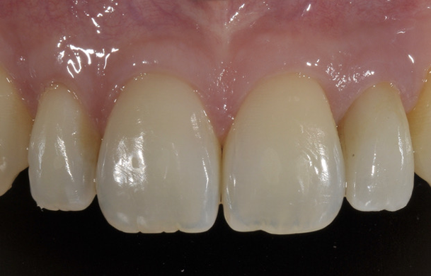 img-paniz-servizi-15-2