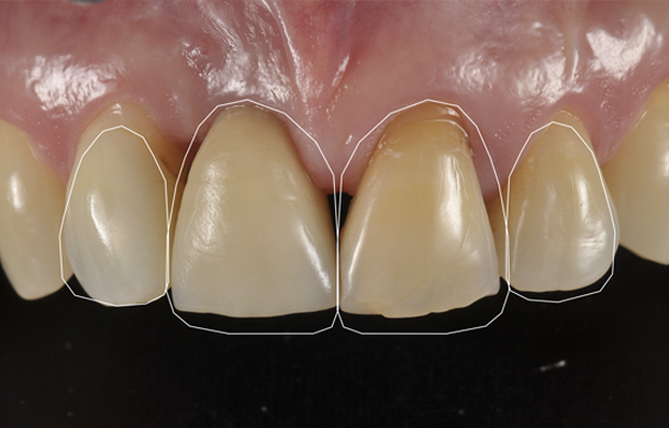 img-paniz-servizi-8-2