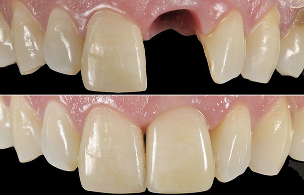 img-paniz-servizi-9-2